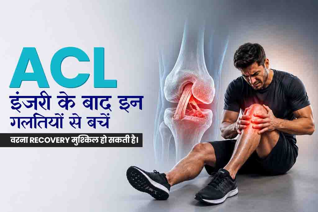 ACL इंजरी के बाद इन गलतियों से बचें – वरना Recovery मुश्किल हो सकती है। 2 ACL Injury
